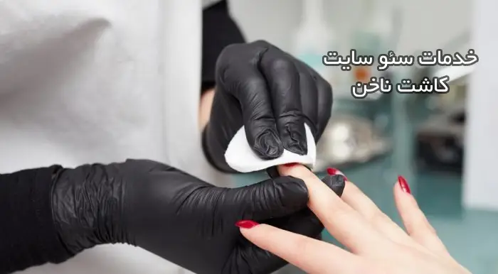خدمات سئو سایت کاشت ناخن